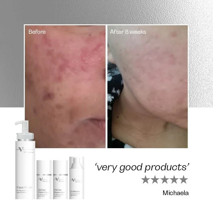 TRIO Blemish Complete Range - Image 3