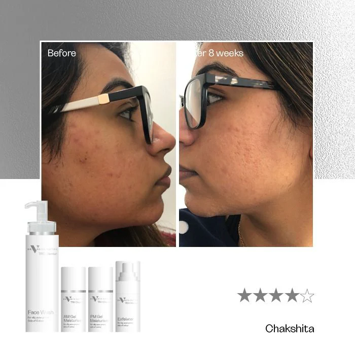 TRIO Blemish Complete Range - Image 4