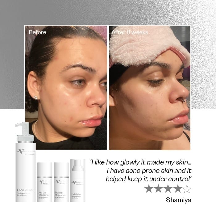 TRIO Blemish Complete Range - Image 5