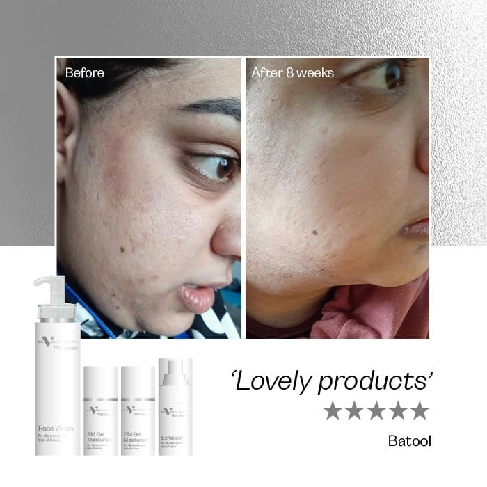 TRIO Blemish Complete Range - Image 6