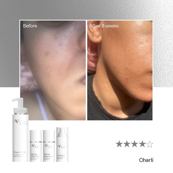 TRIO Blemish Complete Range - Image 7