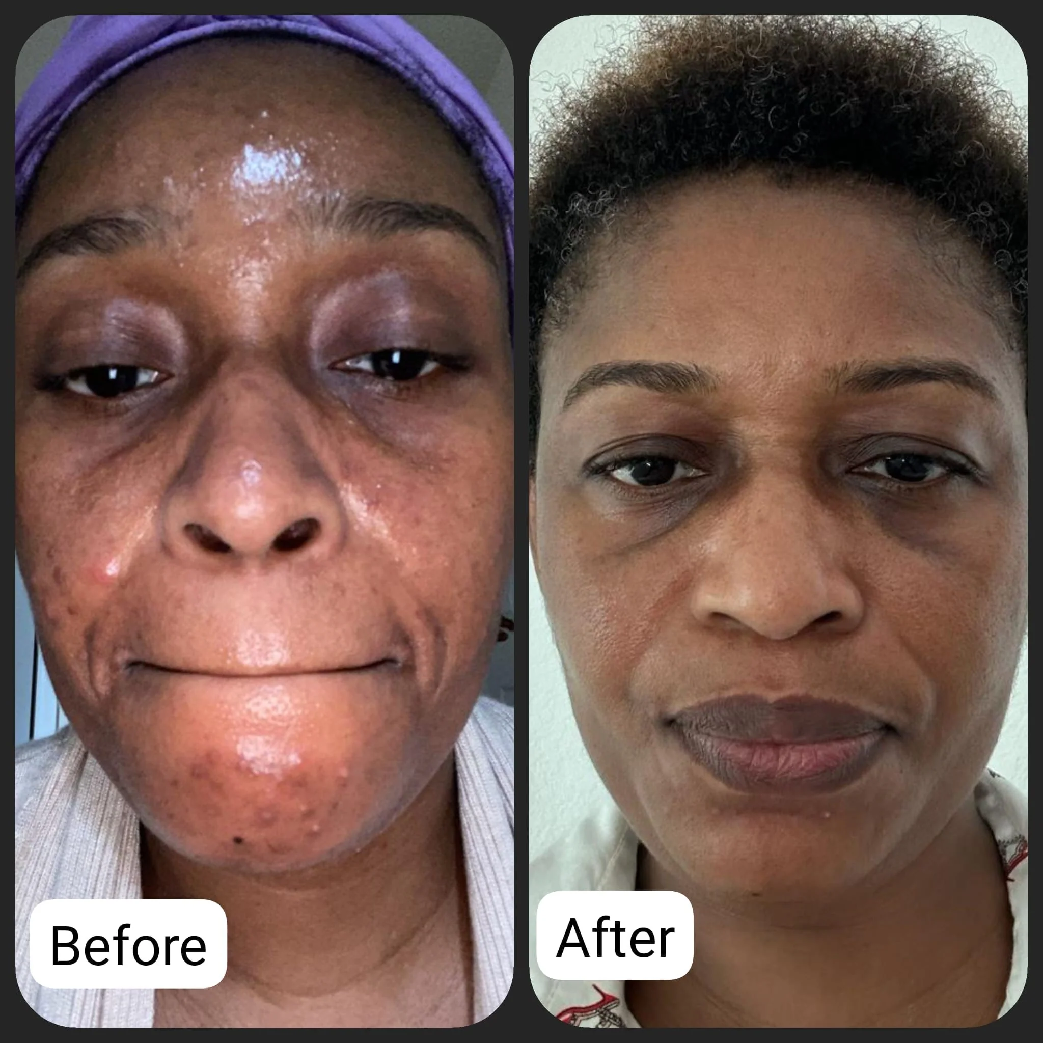 TRIO Blemish Complete Range - Image 8