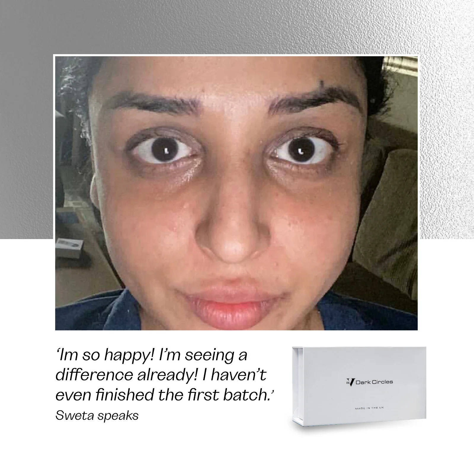 Dark Circles Kit - Image 7