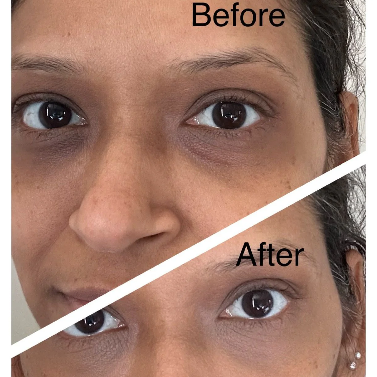 Dark Circles Kit - Image 8