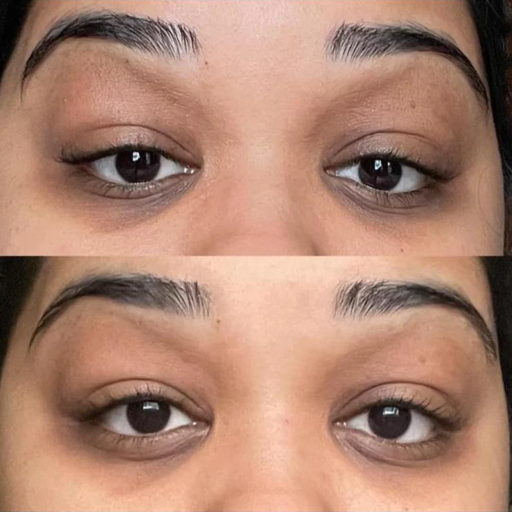 Dark Circles Kit - Image 9