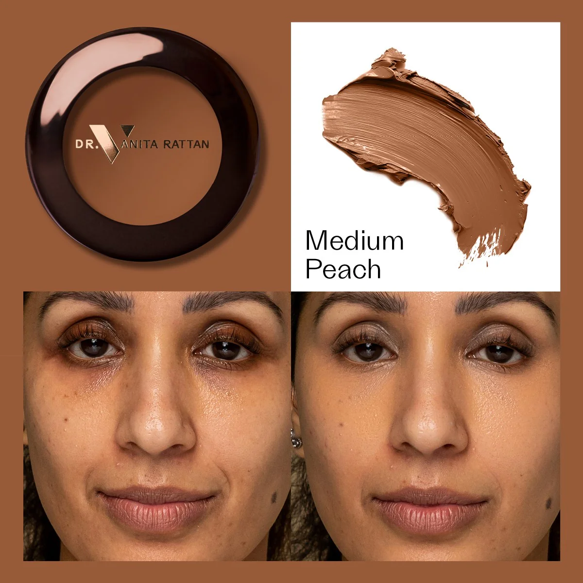 Dr. V Concealer - Image 11