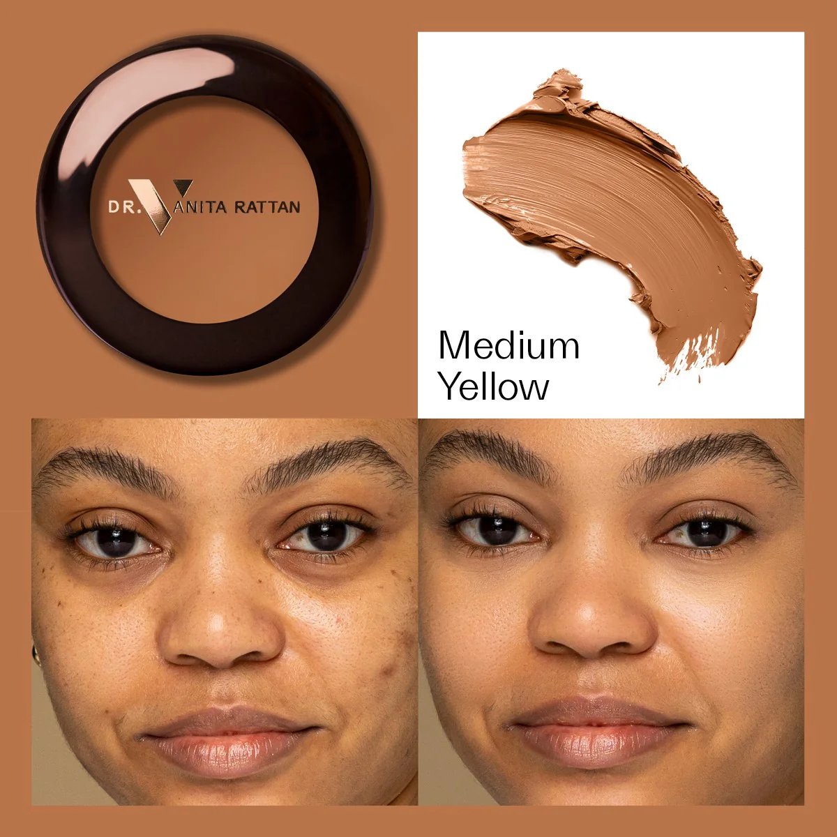 Dr. V Concealer - Image 12