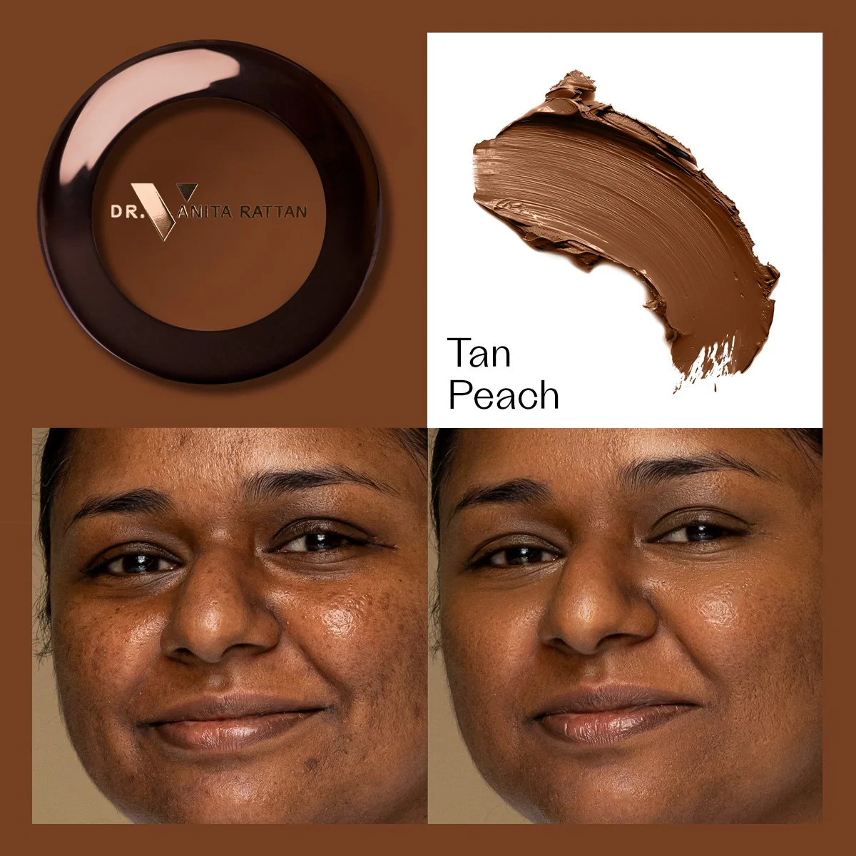 Dr. V Concealer - Image 6