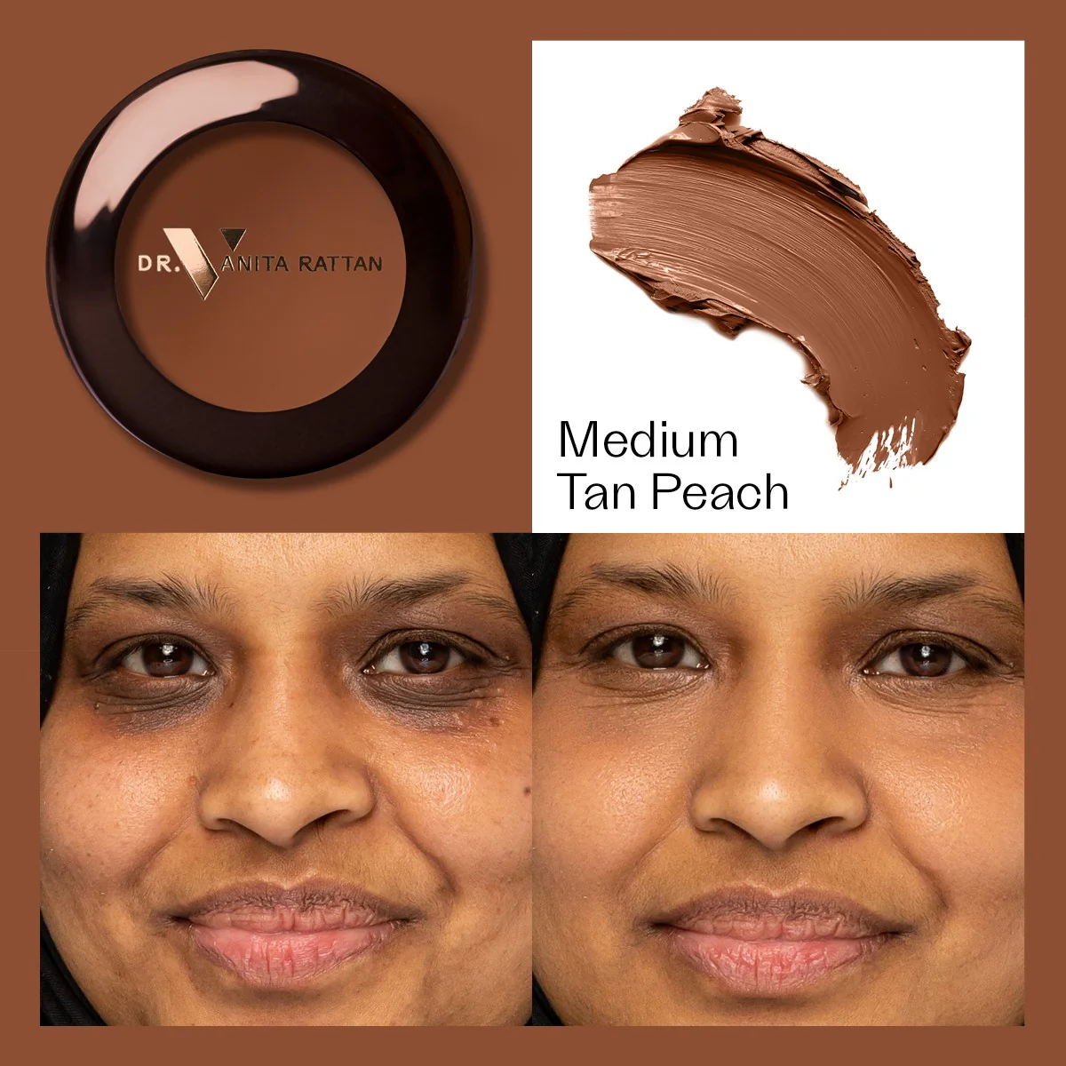 Dr. V Concealer - Image 9