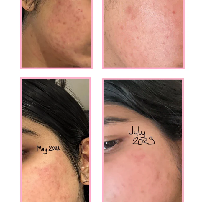 Facial Pigmentation Kit - Image 10