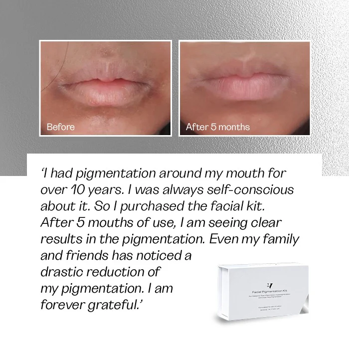 Facial Pigmentation Kit - Image 11