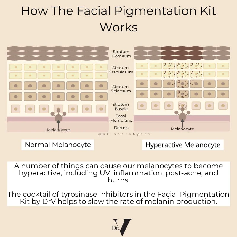 Facial Pigmentation Kit - Image 6