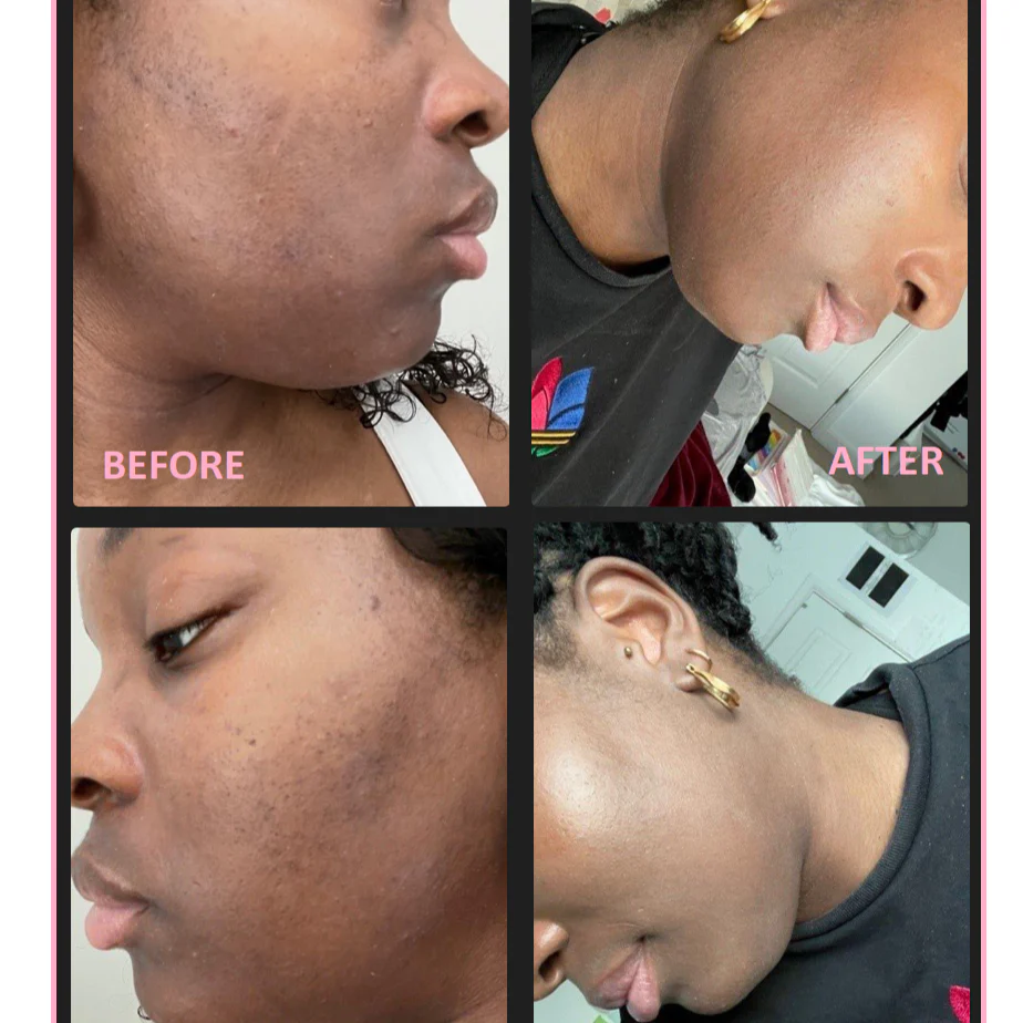 Facial Pigmentation Kit - Image 9